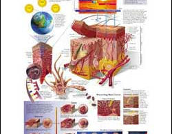 Understanding Skin Cancer illustrated chart