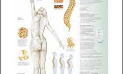 Chart illustrates osteoporosis