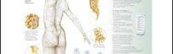 Chart illustrates osteoporosis
