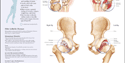 Chart illustrates joints affected by arthritis