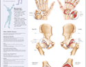 Chart illustrates joints affected by arthritis