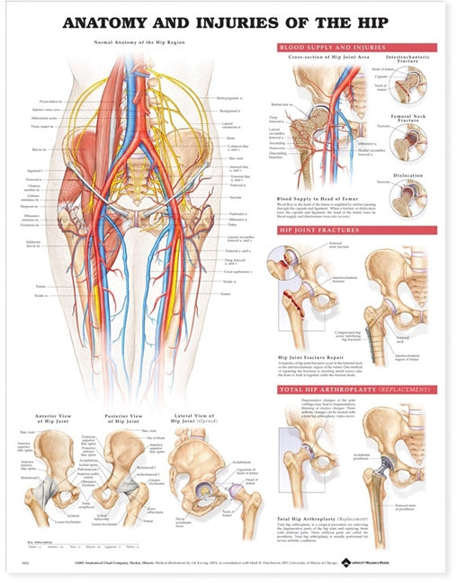 Anatomy and Injuries of the Hip Wall Chart - Laminated, 20"W x 26"L
