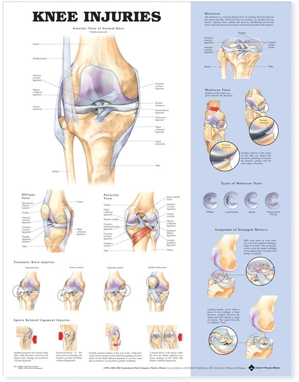 Knee Injuries Wall Chart- Laminated, 20"W x 26"L
