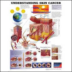 Understanding Skin Cancer Wall Chart- Laminated, 20"W x 26"L