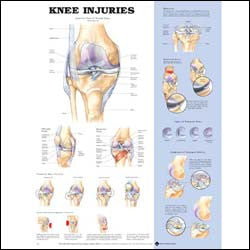 Chart illustrates injuries of the knee
