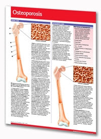 Osteoporosis Permachart